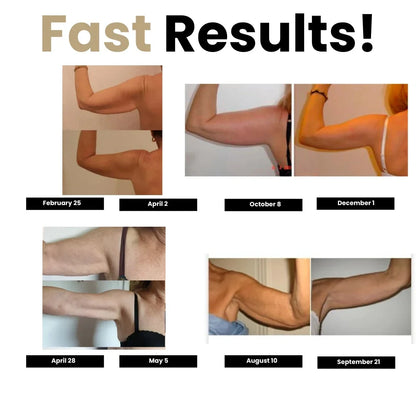 3D compression sleeves